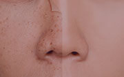 Facial Despigmentante Antimanchas